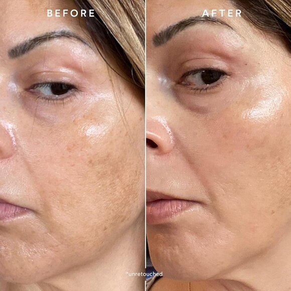 True Botanicals-Phyto-Retinol Vitamin A Booster Facial Serum-Fine Lines & Wrinkl - Picture 2 of 4